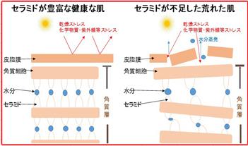 セラミドが豊富な健康な肌とセラミドが不足した荒れた肌のイラスト